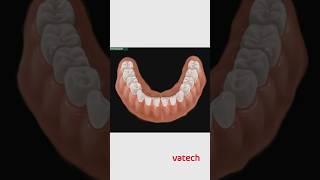 Консультация в программном обеспечении EzDent-i #vatech #стоматология #зубы