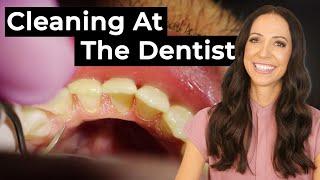 How Teeth Are Cleaned At The Dentist