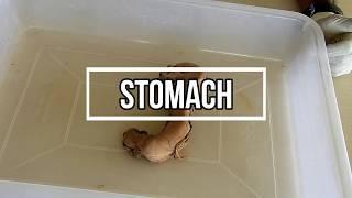 Stomach - gross anatomy