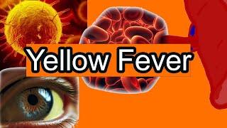 Yellow Fever Explained Simply: Symptoms and treatment