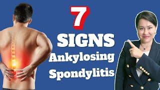 7 Signs of Ankylosing Spondylitis - A Rheumatologist Review