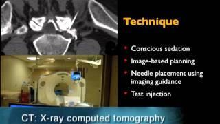 UCSF Radiology: Back Pain Management at the Root