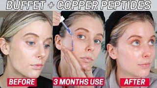 I Used a Full Bottle of The Ordinary Buffet + Copper Peptides 1... Copper Peptides Skin Results