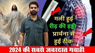 Hindu Man Sees Medical Miracle Through Jesus || हमने तो बिल्कुल आश छोड़ दी थी ||