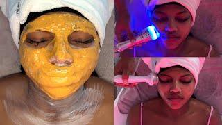 Luxury Facial | Hydrodermabrasion , Cold Therapy & Ultrasound