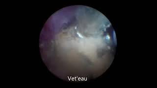 Vet'eau-Endoscopie : Retrait d'un corps étranger digestif par endoscopie cloaquale chez un axolotl