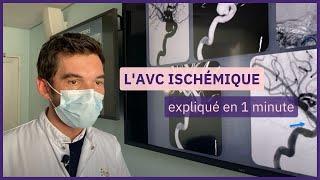 Question de santé : qu'est-ce qu'un AVC ischémique ?