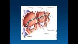 Atrial Fibrillation So: Common It Could Happen to You