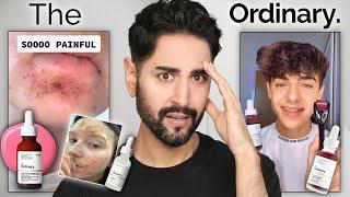 Are The Ordinary's Products Actually Dangerous? The Truth About The Chemical Burn Claims