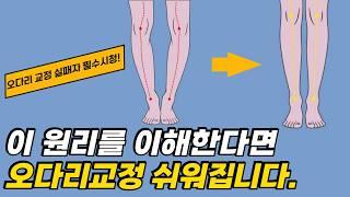 이것! 모르면 오다리, 휜다리 평생 못 고칩니다