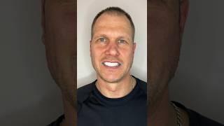 Say hello to Jānis and his stunning smile transformation with Medlife Group #dentist #smile  #funny