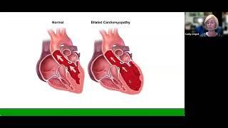 DCM Basics - Causes, Symptoms, and Treatments