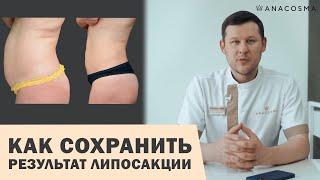 ЛИПОСАКЦИЯ  ОПАСНО ДО ПОХУДЕНИЯ ИЛИ ПОСЛЕ? 