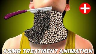 ASMR Deep Neck Cleaning & Treatment Animation | Relax with Royal ASMR