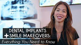 The “Life-Altering” Potential of Dental Implants | Wall St Dental Spa | Dentists in NYC