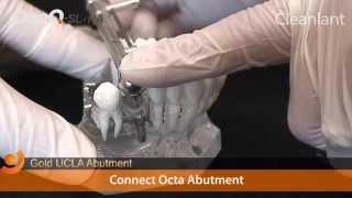 Gold UCLA Abutment - DENTIS Implant