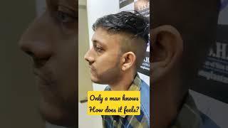 Beard transplant | how to grow beard? | because beard matters | hair transplant cost | best results