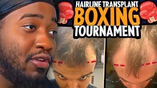 I'm Hosting A Hairline Transplant Boxing Tournament