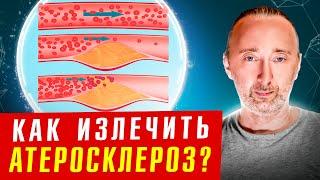 Как очистить сосуды даже если ничего не помогает?