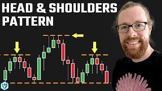 Head and Shoulders Pattern: Day Trading Strategy for Beginners #stockmarket #daytrading