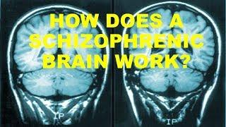 How does a Schizophrenic brain work?