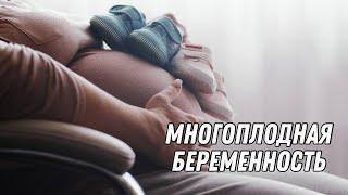 МНОГОПЛОДНАЯ БЕРЕМЕННОСТЬ @DrOlenaB