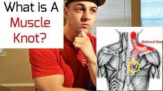 What is a Muscle Knot?