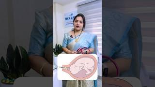 Natural ways to induce labor pains for normal vaginal delivery #bestgynecologist || Dr G Naga Sudha