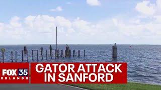 Florida man attacked by alligator while swimming in Seminole County lake