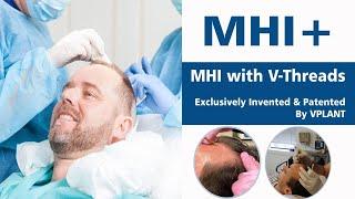 Upgraded Hair Transplant Treatment|| MHI+|| First Time in India