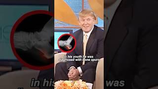 What happened to Trump’s feet#youtubeshorts #shorts #celebrity #trump