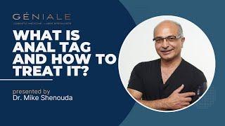 What is Anal Tag and How to Treat It? | Dr Mike Shenouda #nonsurgical  #education