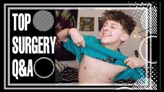 EVERYTHING YOU NEED TO KNOW ABOUT TOP SURGERY | NOAHFINNCE