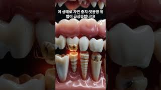 #건강상식 #1분건강 #양치시간 #충치예방 #불소치약 #밤양치 #TMI지만유익해