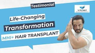 Transforming Lives: Incredible Testimonials of the Best Hair Transplant Results