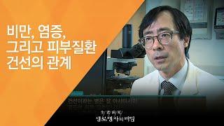 비만, 염증, 그리고 피부질환 건선의 관계 - (20121110_435회 방송)_평생의 고통, 건선