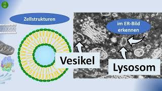 Zellstrukturen im Elektronenmikroskopischen Bild identifizieren