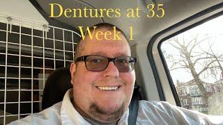 Week 1 with immediate dentures after 24 teeth extracted. Dentures at 35