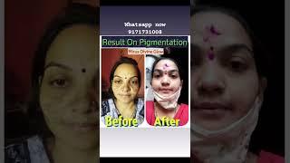 Mirus_divine_Glow cream #dark_spots #pigmentation #skinglow #face #skincare #skincareroutine  #tan
