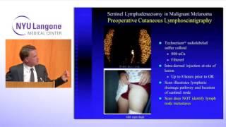 Surgical Treatment of Malignant Melanoma