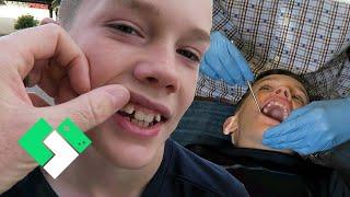 When Is Bryce Getting Braces?! | Clintus.tv