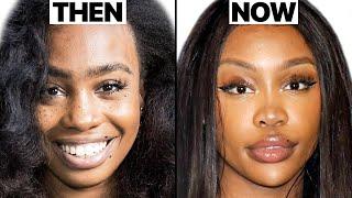 SZA New Face | Plastic Surgery Analysis