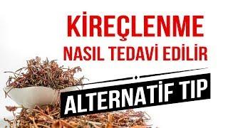 Kireçlenme ( Osteoartrit ) Nasıl Tedavi Edilir? DOĞAL ÇÖZÜM YOLLARI