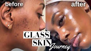 HOW I CLEARED MY HYPERPIGMENTATION, ACNE, AND DARK SPOTS!! | GLASS SKIN ROUTINE *MUST WATCH*