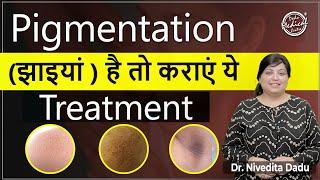 Pigmentation Treatment with DMC-BIO EXFO | Pigmentation kaise hataye? | Dr. Nivedita Dadu