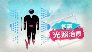 中山醫學大學附設醫院皮膚科 賴柏如醫師--光照治療 衛教影片