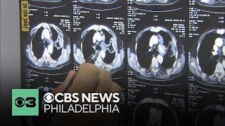 Boston hospital offering one-visit procedure to treat lung cancer patients