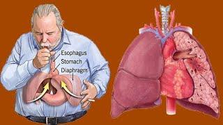 Shortness Of Breath (Dyspnea): Causes And Symptoms