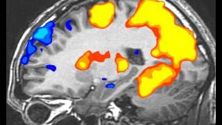 fMRI BrainScan: SideView