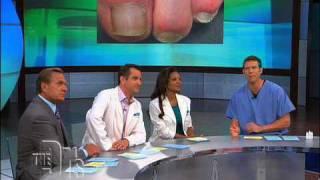 The Doctors on Laser Toenail Fungus Removal